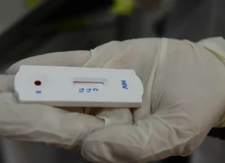 Saúde orienta farmácias sobre testes para HIV, sífilis e hepatites