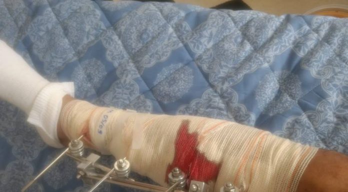 EX VEREADOR DE OSASCO SE LIVRA DA MORTE EM ACIDENTE COM MOTOCICLETA