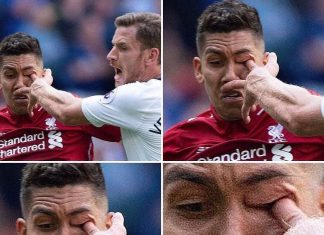 IMAGEM FORTE: Firmino leva dedada “inacreditável” no olho
