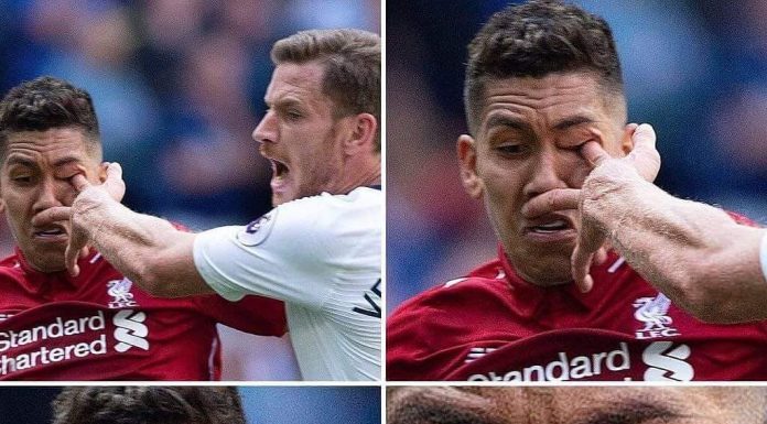 IMAGEM FORTE: Firmino leva dedada “inacreditável” no olho