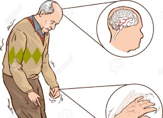 Cientistas descobrem estágios iniciais do Mal de Parkinson