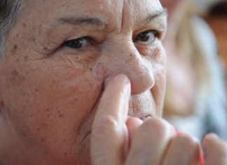 Mutirão fará diagnóstico precoce de câncer de pele em todo o país