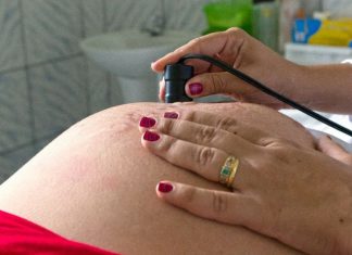 Lei que autoriza cesárea sem motivo médico é inconstitucional, diz TJ