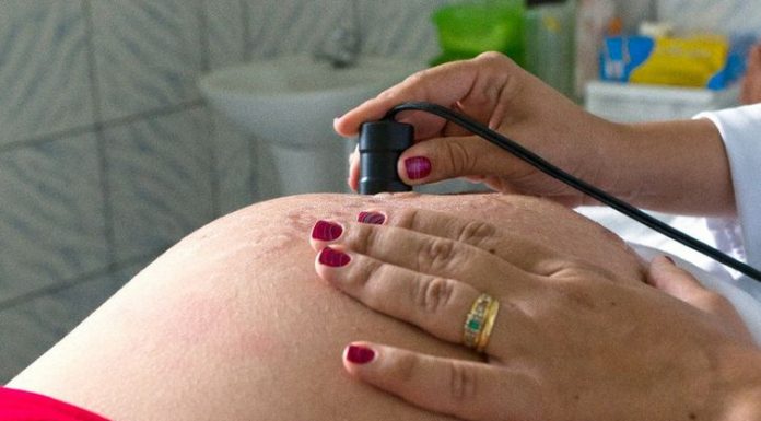 Lei que autoriza cesárea sem motivo médico é inconstitucional, diz TJ