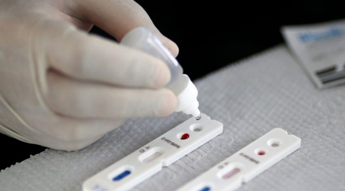 Butantan busca desenvolver vacina alternativa contra covid-19