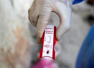 Covid-19: Brasil chega a 47,7 mil mortes e 978,1 mil casos confirmados