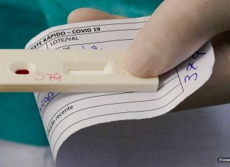 Brasil chega a 2 milhões de casos acumulados de covid-19