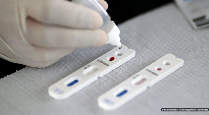 Covid-19: Brasil tem 55.891 novos casos confirmados nas últimas 24h