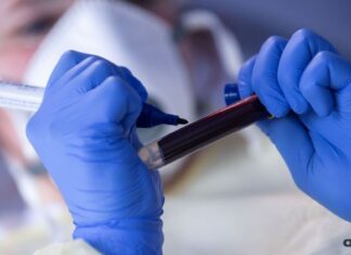 Covid-19: Brasil tem 164 mil mortes e 5,78 milhões de casos acumulados
