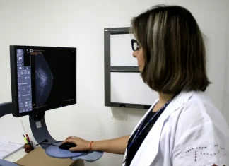 Entidades médicas pedem faixa etária maior para mamografia de rastreio