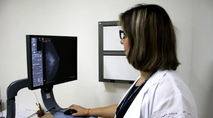 Entidades médicas pedem faixa etária maior para mamografia de rastreio