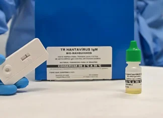 Novo teste faz diagnóstico de hantavirose em 20 minutos