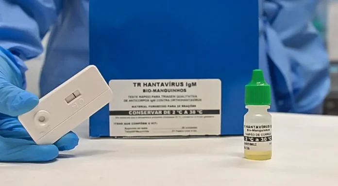 Novo teste faz diagnóstico de hantavirose em 20 minutos