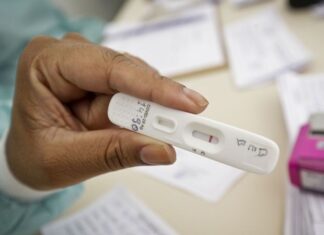 Anvisa aprova primeira marca de autoteste do Brasil