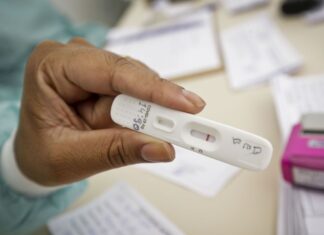 Anvisa aprova uso e comercialização de autoteste para covid-19