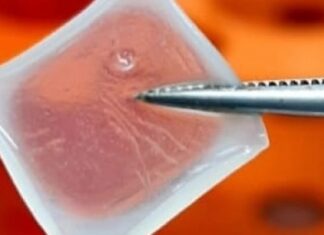 Biocurativo de células-tronco permite o tratamento inteligente de feridas e queimaduras