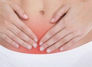 Endometriose: entenda o que é e qual o tratamento