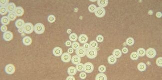 Exames que identificam fungos que afetam sistema nervoso entram no SUS