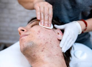 Controle da acne e oleosidade: descubra os tratamentos mais indicados para pele masculina