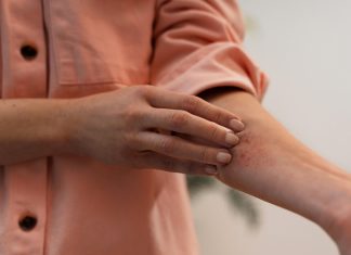 Picadas de insetos: como prevenir e agir em casos de reação alérgica