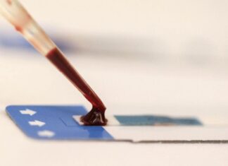 Pesquisadores desenvolvem nova abordagem para combater vírus da Aids