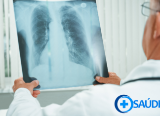Saúde de Jandira inicia campanha contra tuberculose