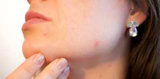 Acne na Adolescência: O Pesadelo dos Hormônios em Fúria 😱