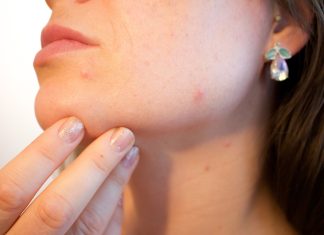 Acne na Adolescência: O Pesadelo dos Hormônios em Fúria 😱