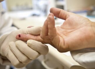 Rio: Justiça proíbe exigência de teste HIV para candidatos a concursos