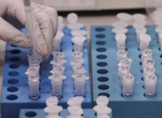 UFRJ desenvolve teste de baixo custo para detecção de covid-19