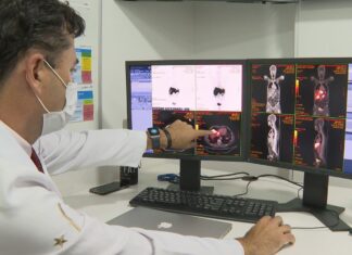 Inca prevê 44 mil casos novos de câncer colorretal no Brasil por ano