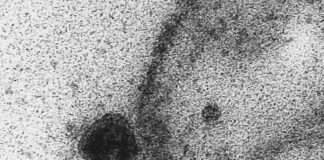 Aplicativo alimentado por tosses pode ajudar na detecção da covid-19