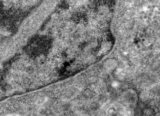 Pesquisa detecta coronavírus pela análise de retina