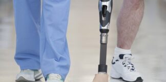 No Brasil, tecnologia de foguetes é usada em órteses e próteses