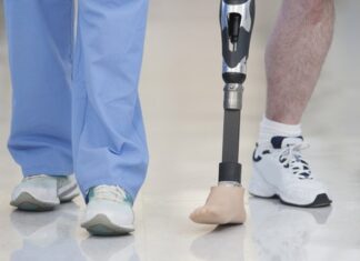 No Brasil, tecnologia de foguetes é usada em órteses e próteses