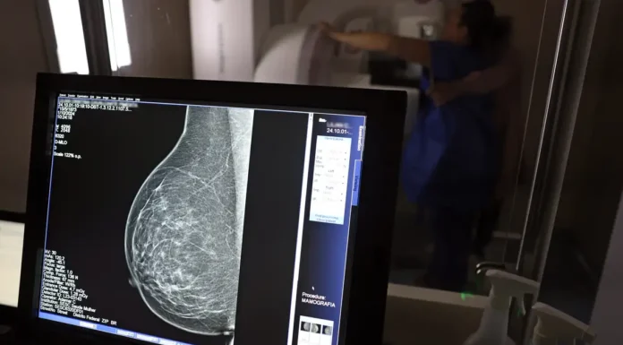 Falta de acesso a mamógrafos limita prevenção do câncer de mama