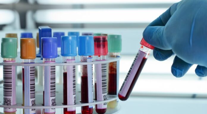 Lei determina que empresas divulguem campanhas de conscientização sobre vacinas, HPV e câncer Lei determina que empresas divulguem campanhas de conscientização sobre vacinas, HPV e câncer