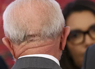 Lula recebe liberação médica para viajar de avião