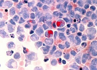 Anvisa aprova primeira terapia gênica contra câncer no Brasil