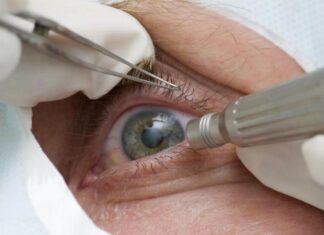 Guia tenta evitar expansão de casos de cegueira por glaucoma