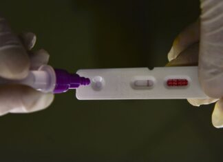 Pesquisadores identificam método capaz de prever gravidade da covid-19